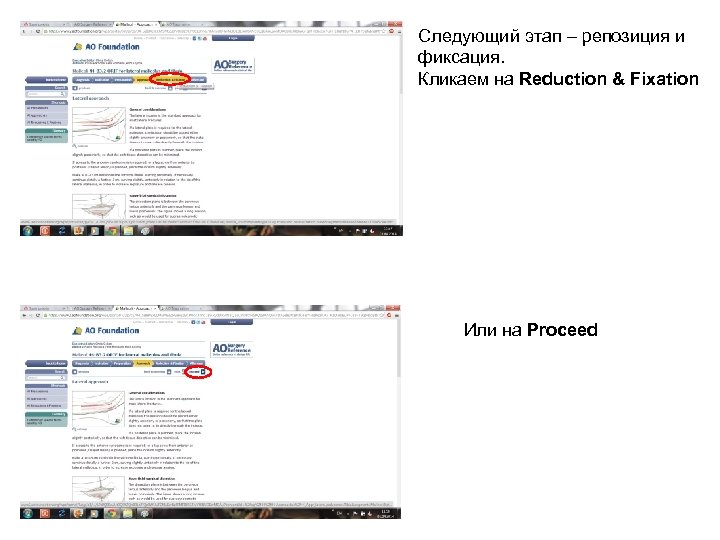 Следующий этап – репозиция и фиксация. Кликаем на Reduction & Fixation Или на Proceed