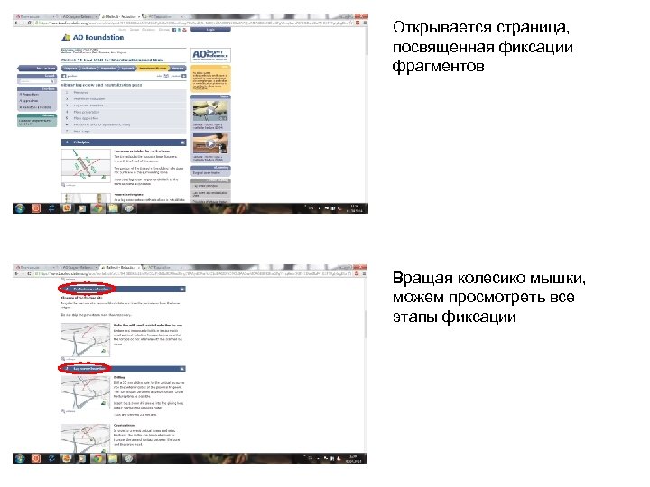 Открывается страница, посвященная фиксации фрагментов Вращая колесико мышки, можем просмотреть все этапы фиксации 