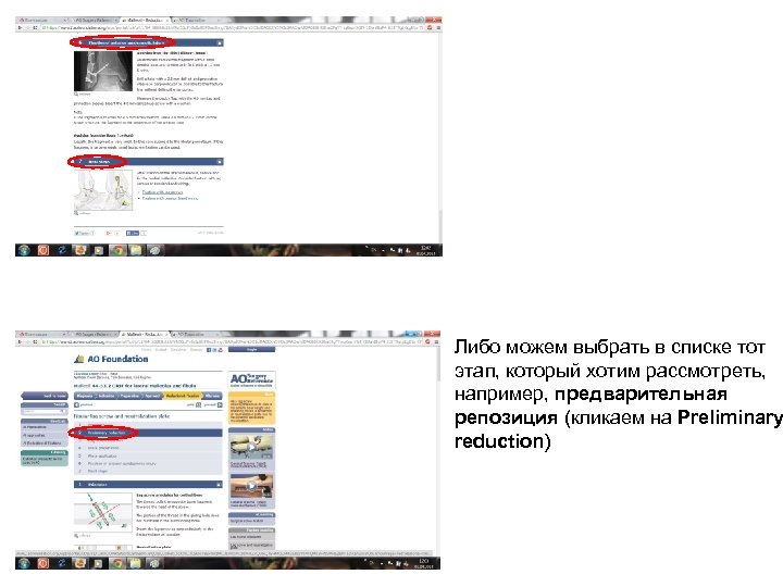 Либо можем выбрать в списке тот этап, который хотим рассмотреть, например, предварительная репозиция (кликаем