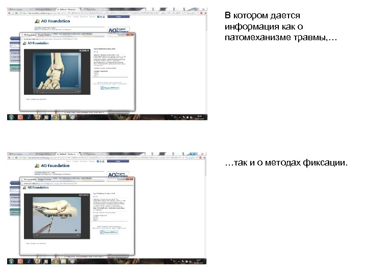 В котором дается информация как о патомеханизме травмы, … …так и о методах фиксации.