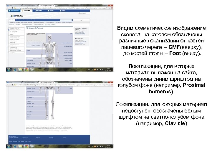 Видим схематическое изображение скелета, на котором обозначены различные локализации от костей лицевого черепа –