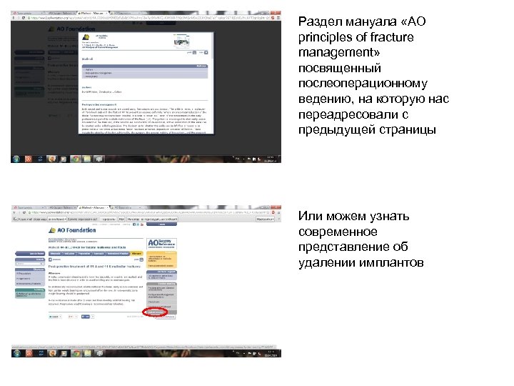 Раздел мануала «AO principles of fracture management» посвященный послеоперационному ведению, на которую нас переадресовали