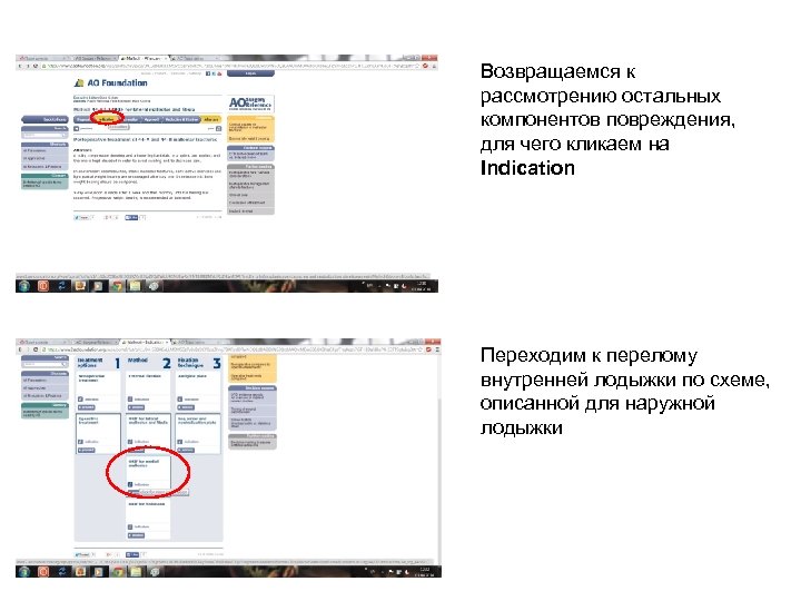 Возвращаемся к рассмотрению остальных компонентов повреждения, для чего кликаем на Indication Переходим к перелому
