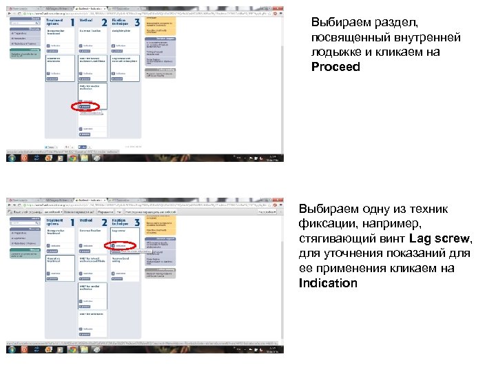 Выбираем раздел, посвященный внутренней лодыжке и кликаем на Proceed Выбираем одну из техник фиксации,