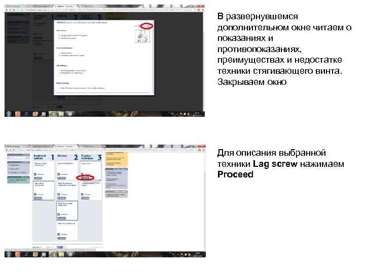 В развернувшемся дополнительном окне читаем о показаниях и противопоказаниях, преимуществах и недостатке техники стягивающего