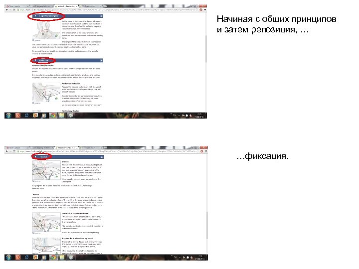 Начиная с общих принципов и затем репозиция, … …фиксация. 