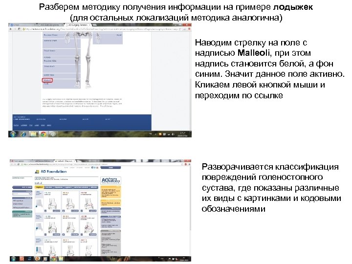 Разберем методику получения информации на примере лодыжек (для остальных локализаций методика аналогична) Наводим стрелку