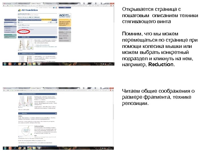 Открывается страница с пошаговым описанием техники стягивающего винта Помним, что мы можем перемещаться по