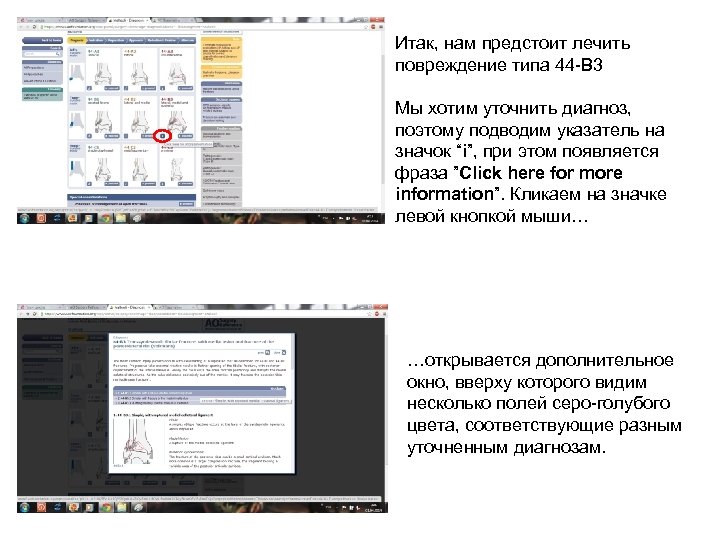 Итак, нам предстоит лечить повреждение типа 44 -В 3 Мы хотим уточнить диагноз, поэтому