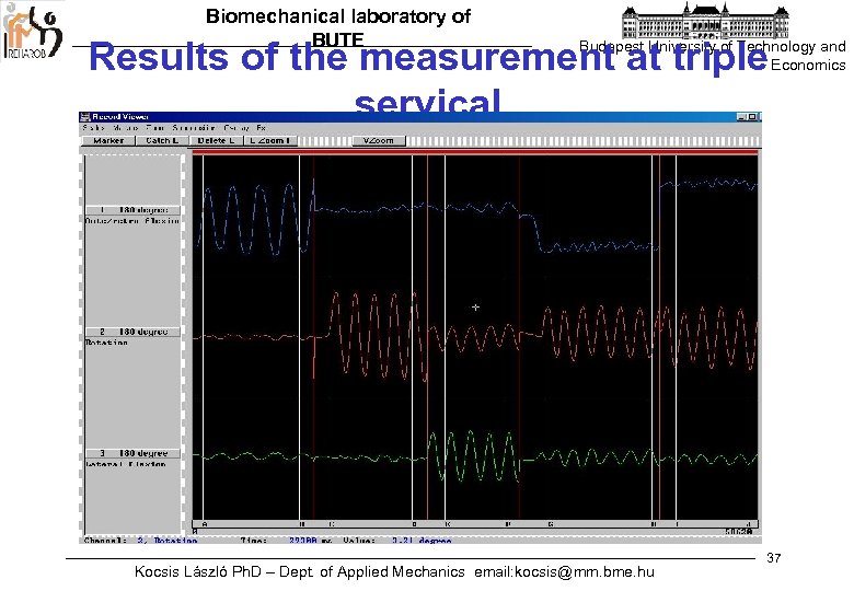 Biomechanical laboratory of BUTE Results of the measurement at triple servical Budapest University of