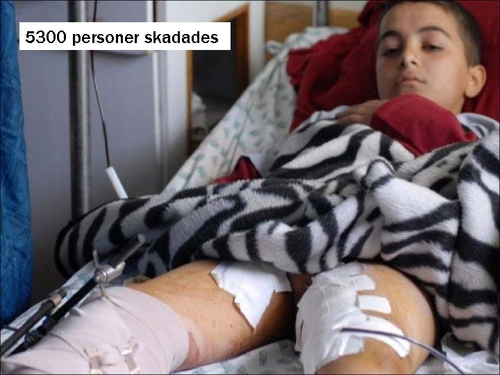 5300 personer skadades 