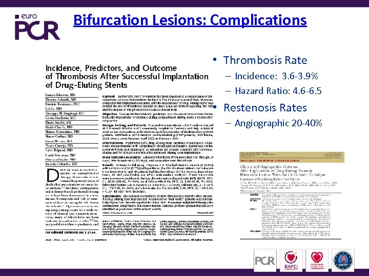 Bifurcation Lesions: Complications • Thrombosis Rate – Incidence: 3. 6 -3. 9% – Hazard