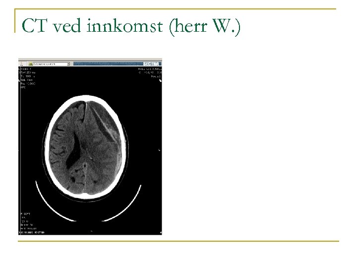 CT ved innkomst (herr W. ) 