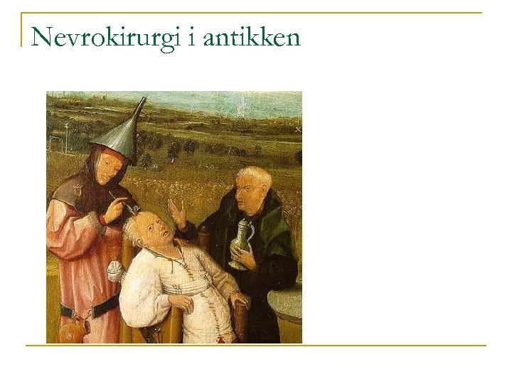Nevrokirurgi i antikken 