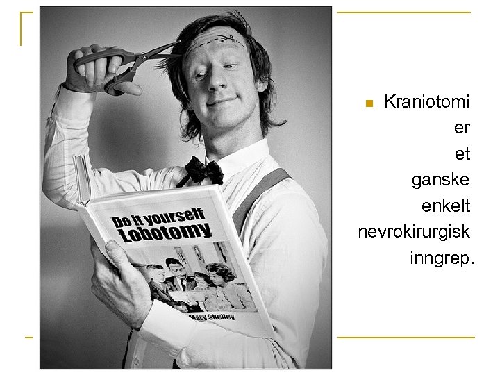 Kraniotomi er et ganske enkelt nevrokirurgisk inngrep. n 