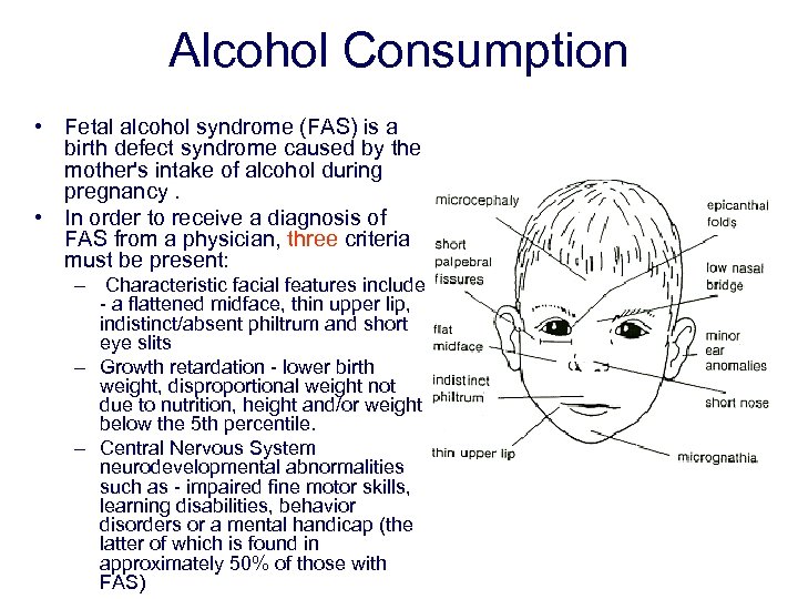 Alcohol Consumption • Fetal alcohol syndrome (FAS) is a birth defect syndrome caused by