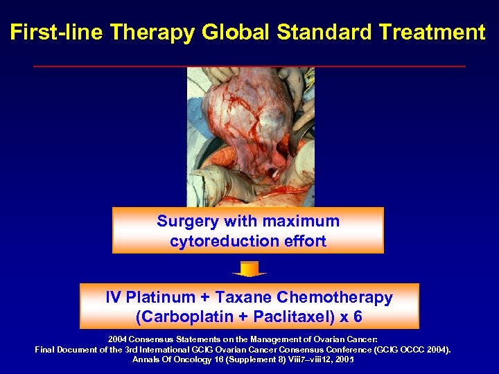 First-line Therapy Global Standard Treatment Surgery with maximum cytoreduction effort IV Platinum + Taxane