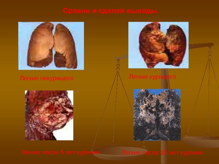 Сравни и сделай выводы. Легкие некурящего Легкие после 5 лет курения Легкие курящего Легкие