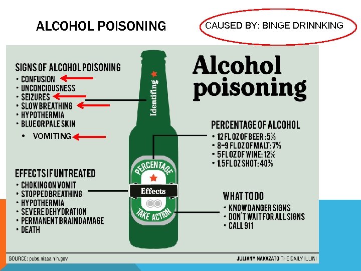 ALCOHOL POISONING • VOMITING CAUSED BY: BINGE DRINNKING 