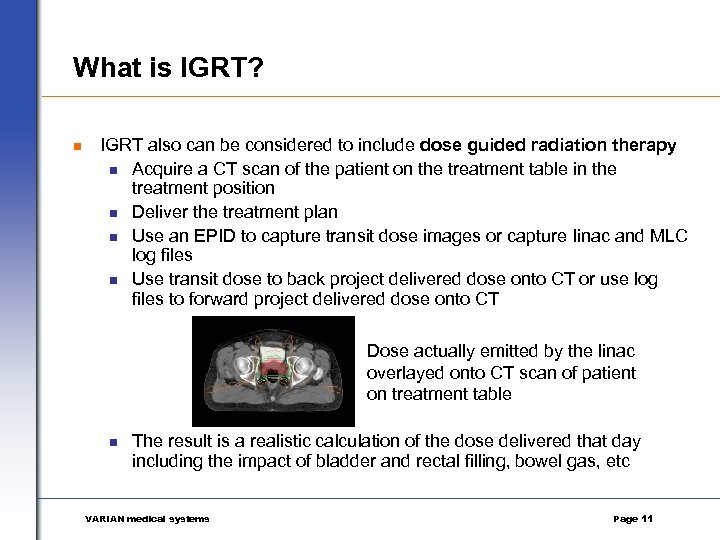 What is IGRT? n IGRT also can be considered to include dose guided radiation