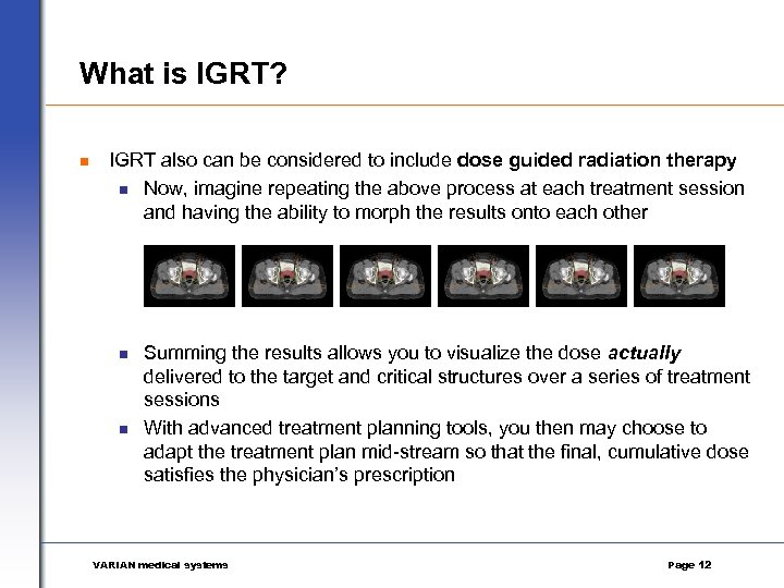 What is IGRT? n IGRT also can be considered to include dose guided radiation