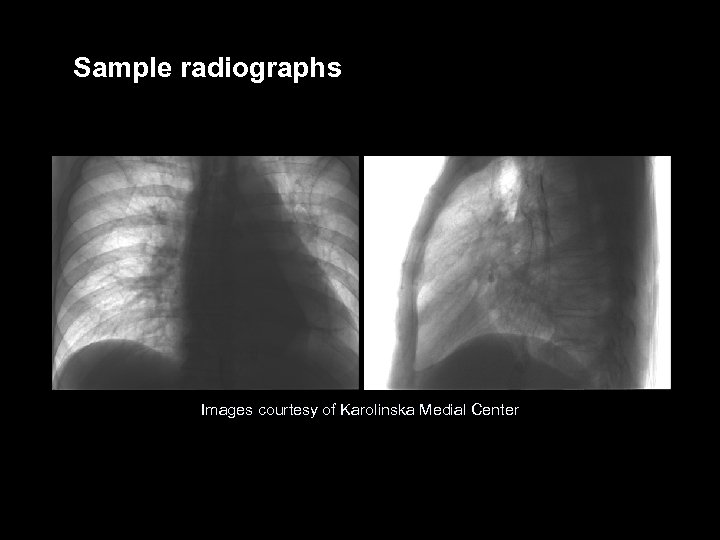 Sample radiographs Images courtesy of Karolinska Medial Center VARIAN medical systems Page 25 