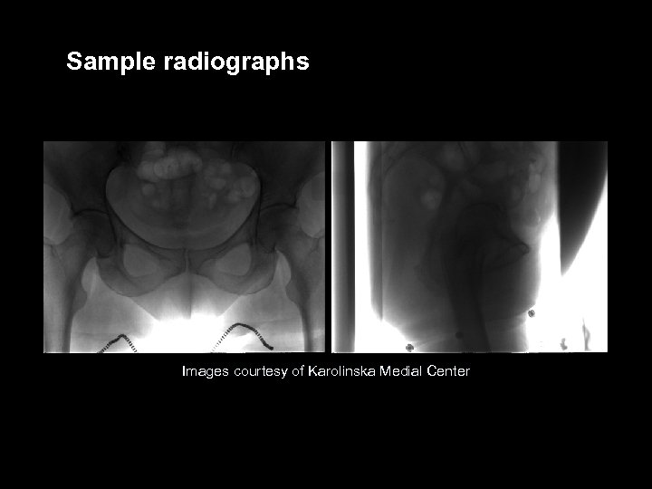 Sample radiographs Images courtesy of Karolinska Medial Center VARIAN medical systems Page 26 