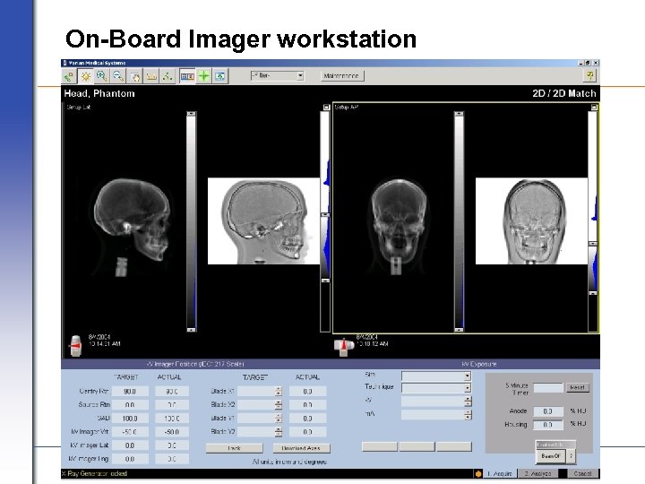 On-Board Imager workstation VARIAN medical systems Page 27 