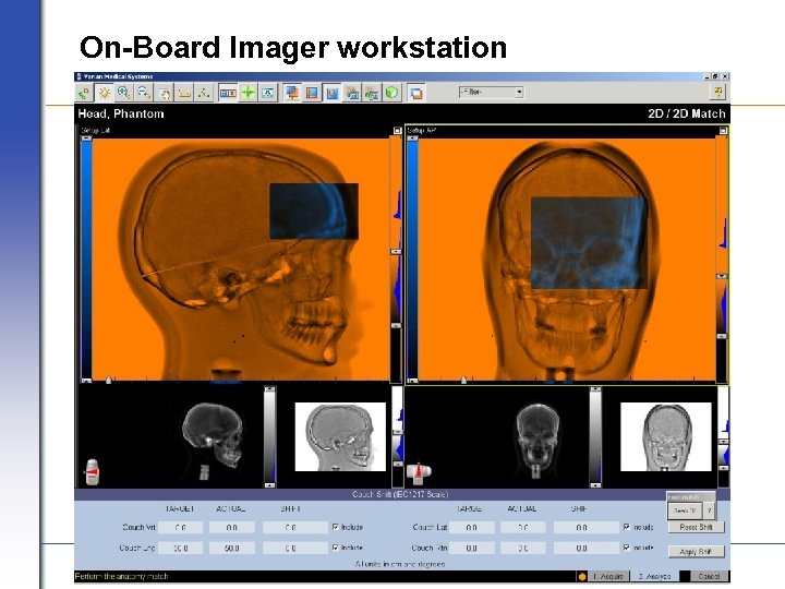 On-Board Imager workstation VARIAN medical systems Page 28 