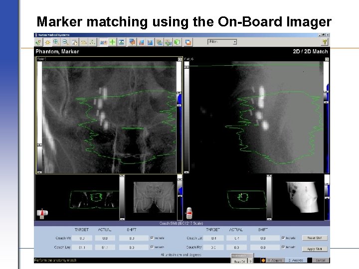 Marker matching using the On-Board Imager VARIAN medical systems Page 29 