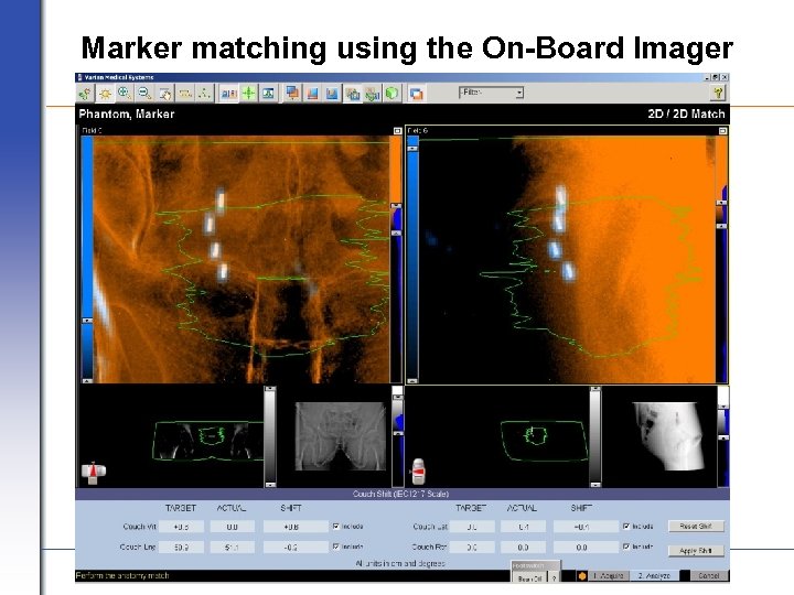 Marker matching using the On-Board Imager VARIAN medical systems Page 30 