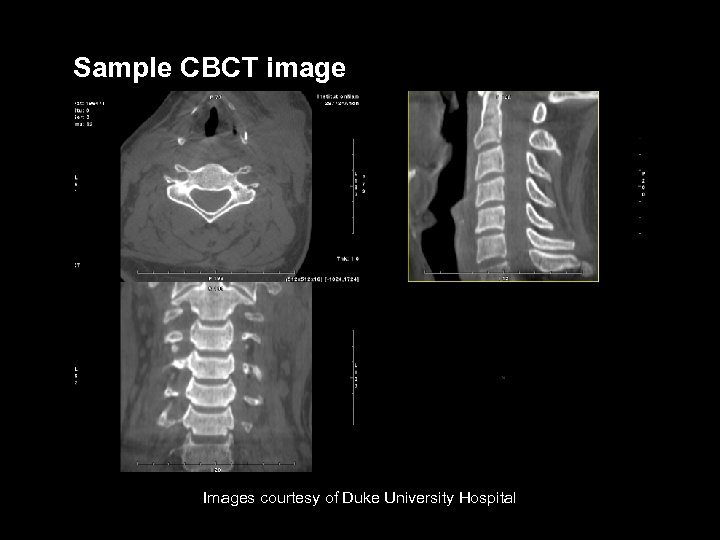 Sample CBCT image Images courtesy of Duke University Hospital VARIAN medical systems Page 40