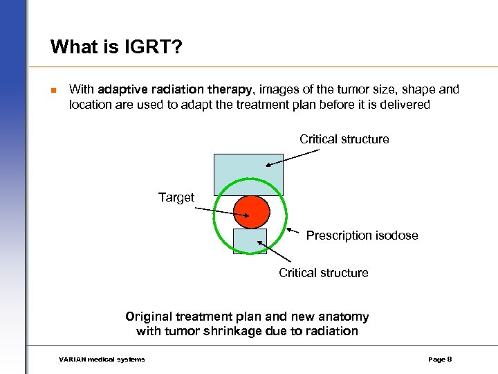 What is IGRT? n With adaptive radiation therapy, images of the tumor size, shape