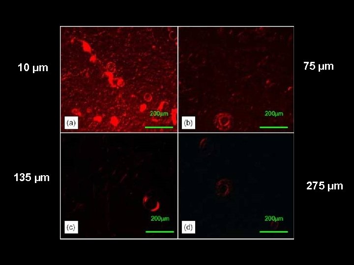 10 µm 135 µm 75 µm 275 µm 