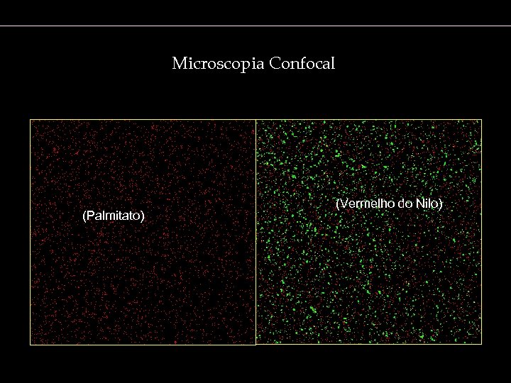 Microscopia Confocal (Palmitato) (Vermelho do Nilo) 