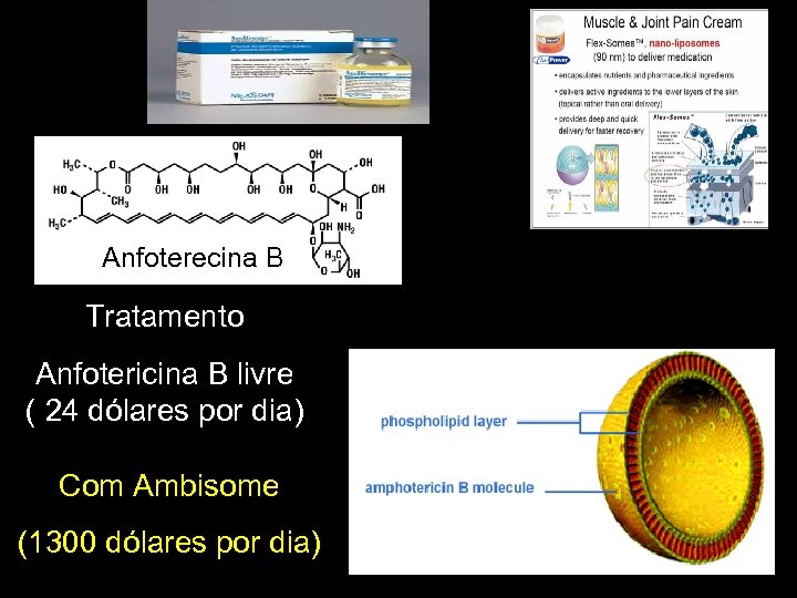 Anfoterecina B Tratamento Anfotericina B livre ( 24 dólares por dia) Com Ambisome (1300