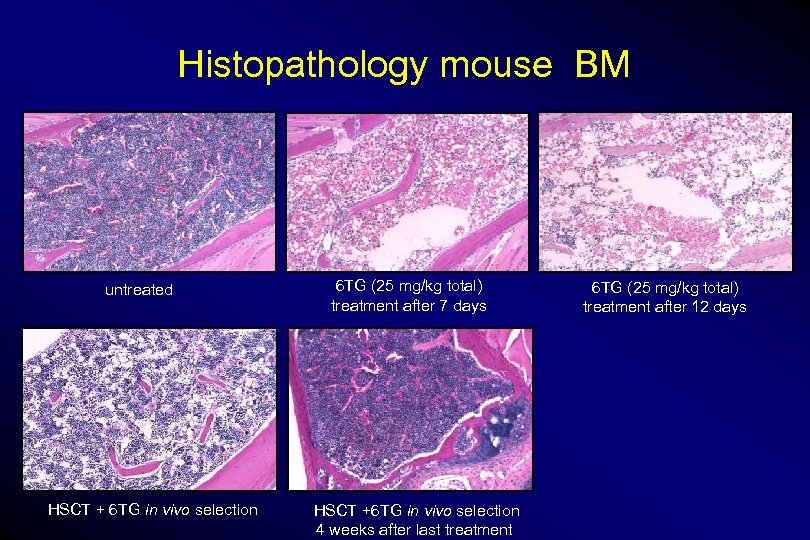 Histopathology mouse BM untreated HSCT + 6 TG in vivo selection 6 TG (25