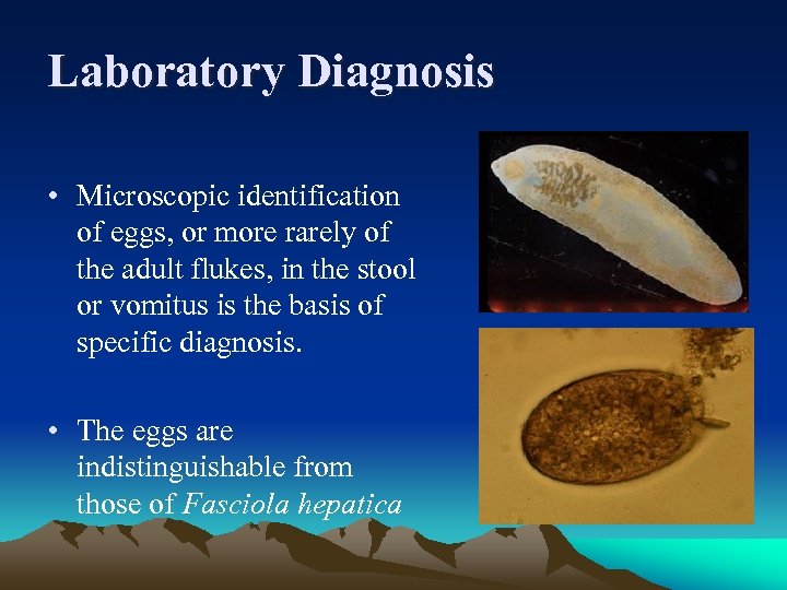 Laboratory Diagnosis • Microscopic identification of eggs, or more rarely of the adult flukes,