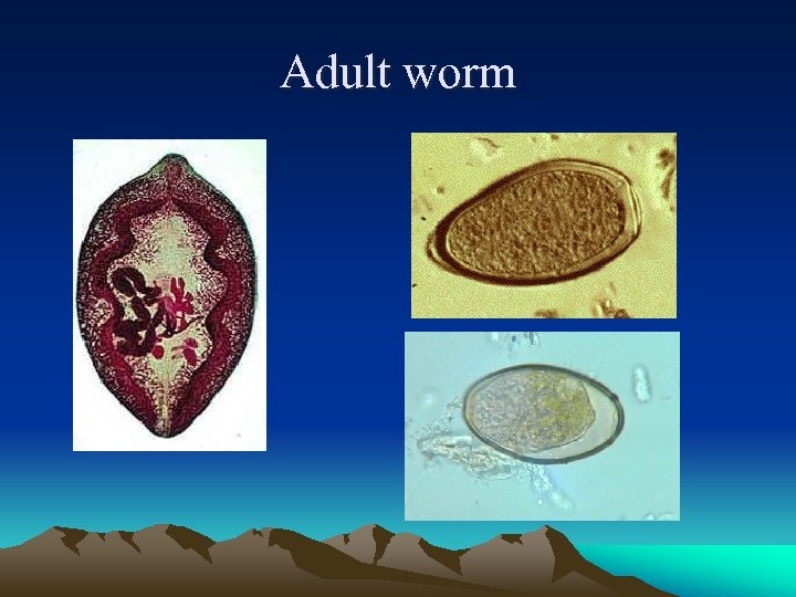 Adult worm 