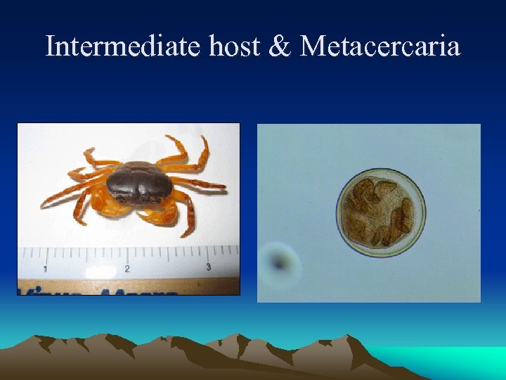 Intermediate host & Metacercaria 