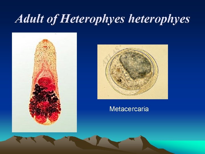Adult of Heterophyes heterophyes Metacercaria 