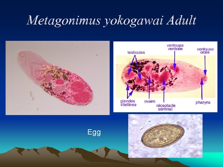 Metagonimus yokogawai Adult Egg 
