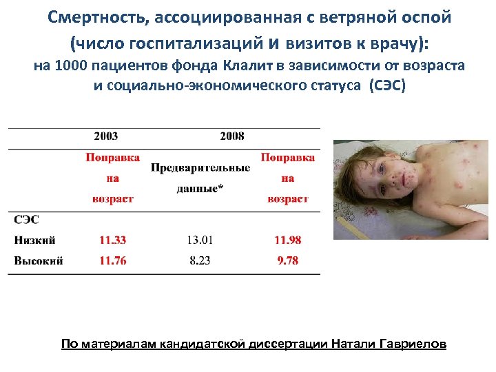 Смертность, ассоциированная с ветряной оспой (число госпитализаций и визитов к врачу): на 1000 пациентов