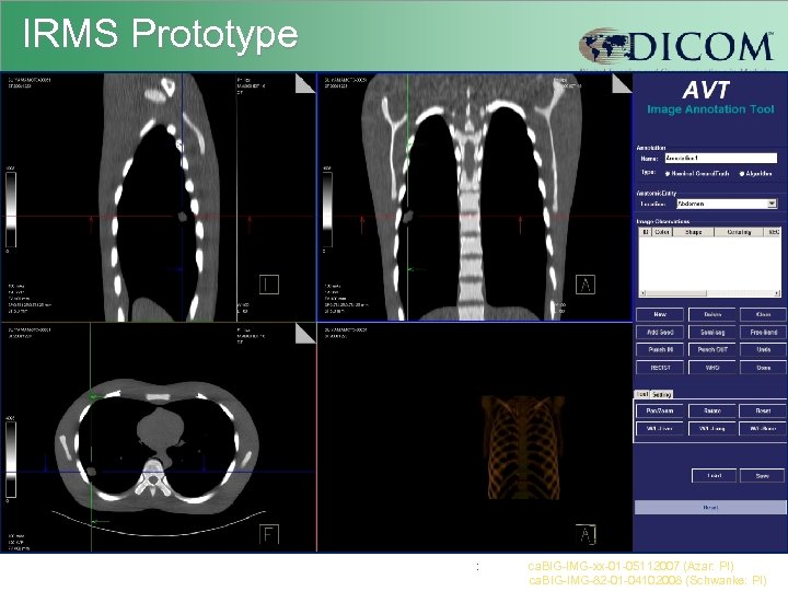 IRMS Prototype : ca. BIG-IMG-xx-01 -05112007 (Azar: PI) ca. BIG-IMG-82 -01 -04102008 (Schwanke: PI)