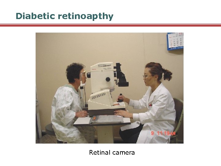 Diabetic retinoapthy Retinal camera 