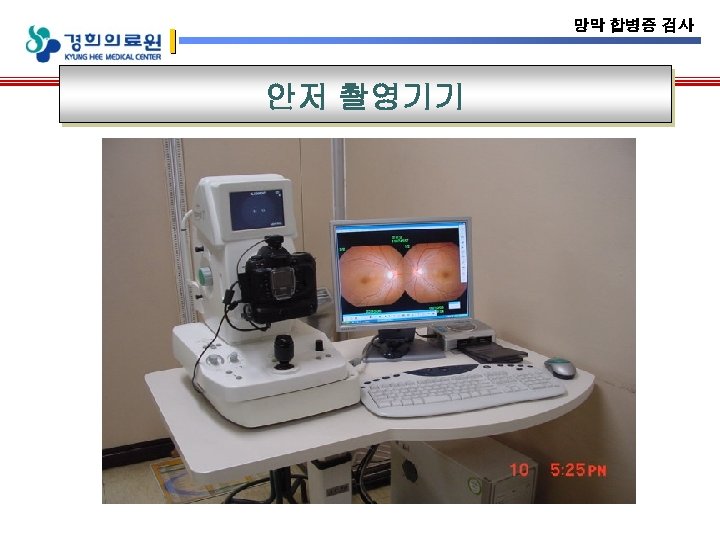 망막 합병증 검사 안저 촬영기기 