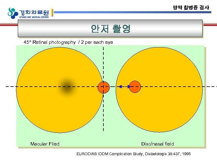 망막 합병증 검사 안저 촬영 45 Retinal photography / 2 per each eye Macular