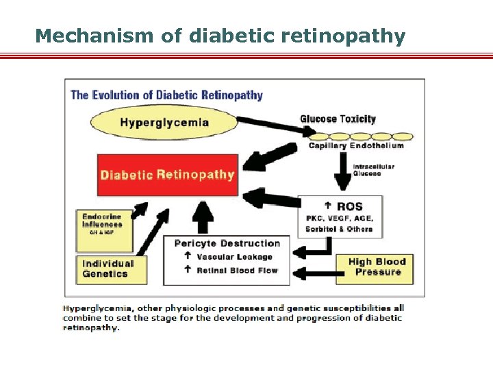 Mechanism of diabetic retinopathy 