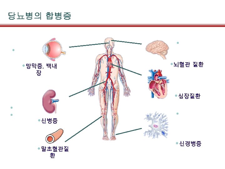당뇨병의 합병증 • Stroke • Diabetic retinopathy • 망막증, 백내 • 뇌혈관 질환 장