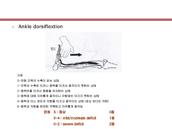 l Ankle dorsiflextion 기준 0 -전혀 근육의 수축이 없는 상태 1 -근육의 수축은 있으나